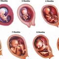 Abortuszvita: nincs jó válasz