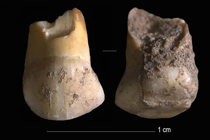 upper-canine-milk-tooth.jpg