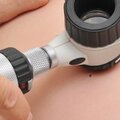 Évente 2500 magyarnál diagnosztizálnak melanomát, a rendszeres szűrés és a fényvédelem azonban életeket menthet