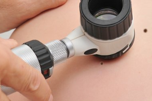 Évente 2500 magyarnál diagnosztizálnak melanomát, a rendszeres szűrés és a fényvédelem azonban életeket menthet