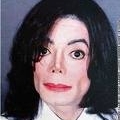 Michael Jackson hagyatéka a plasztikai sebészetre