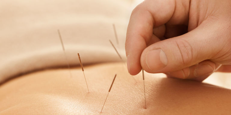 1450188386-g-acupuncture-97538838.jpg