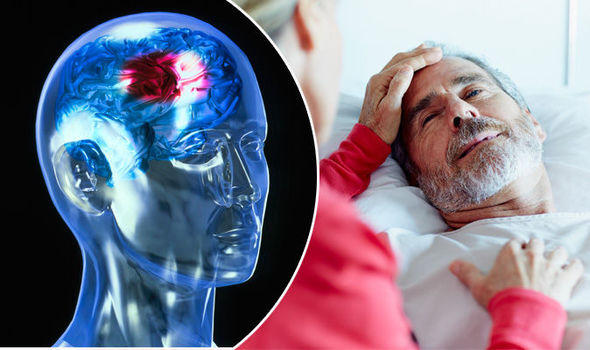 Researchers found that 43% of people who have a stroke notice the same  symptoms a week earlier | Living Smart | NewsBreak Original