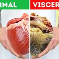 A hasi zsír kialakulásának okai és tippek a leküzdéséhez