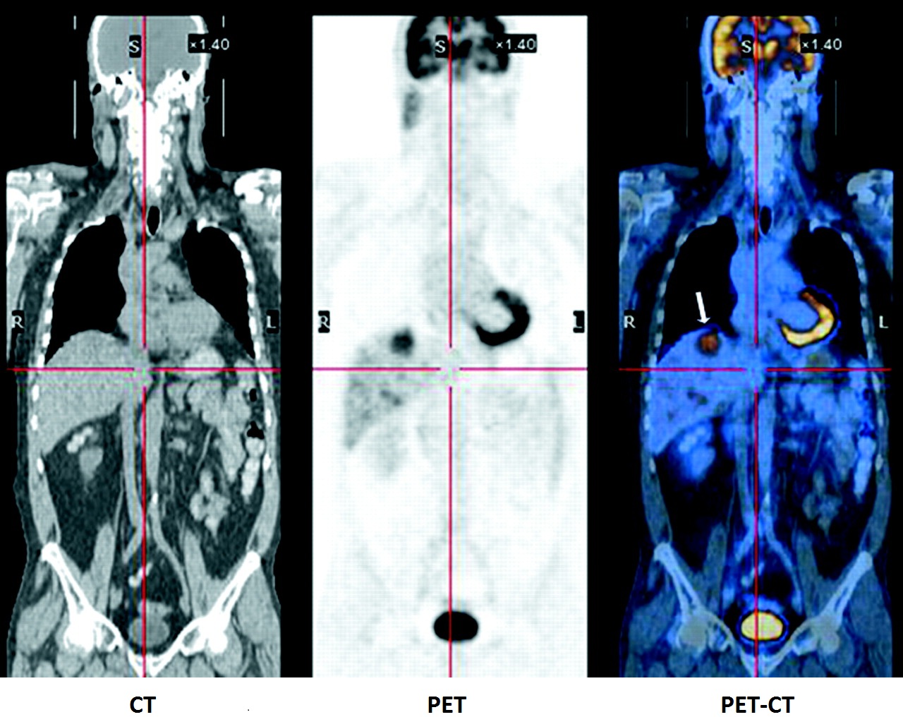 pet-ct.jpg