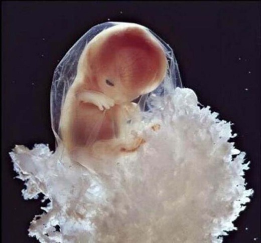 10-het-embrio.jpg