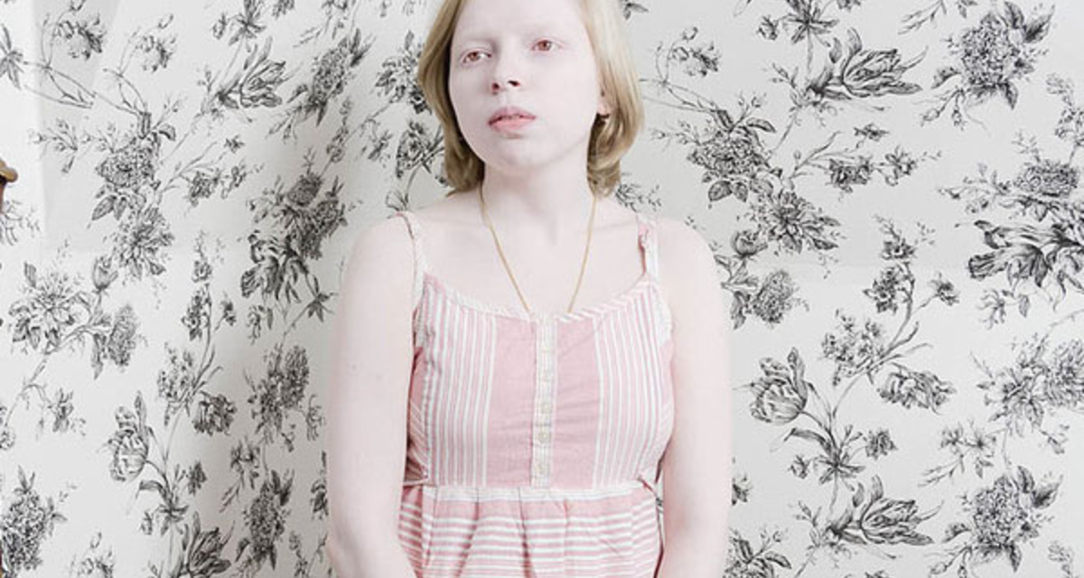 Élet színek nélkül: gyönyörű fotók albínókról