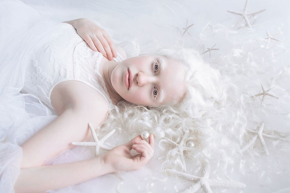 Yulia Taits izraeli fotográfus egy teljes képsorozatot szentelt az albínó emberek szépségének. Művészi gyűjteményének találóan a Porcelain Beauty címet adta.