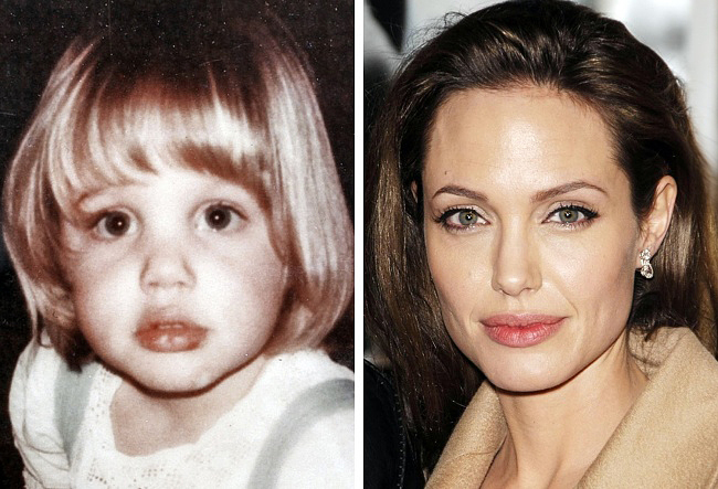 Telt ajkai és szimmetrikus arcberendezése miatt gyakran vádolják azzal Angelina Jolie-t, hogy plasztikai beavatkozásoknak köszönheti szépségét. Gyerekkori fotóján azonban jól látható, hogy már akkor is vastag volt a szája, és az arcvonásai sem sokat változtak azóta.