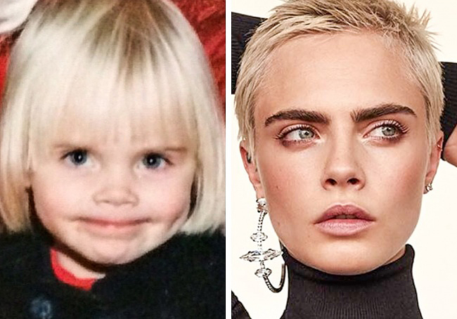 Cara Delevingne jelenleg az ötödik helyen áll a világ szupermodelljeinek rangsorában, és karrierjének csúcsát koptatja. Ám mindvégig sikerült megőriznie egyéniségét, és ezzel megnyerte magának Karl Lagerfeld tiszteletét és rokonszenvét. Ahhoz, amit eddig elért a divatszakmában, nem igazán volt szüksége plasztikai sebészre, hiszen az ő szépségét a belső kisugárzása teszi egyedivé.