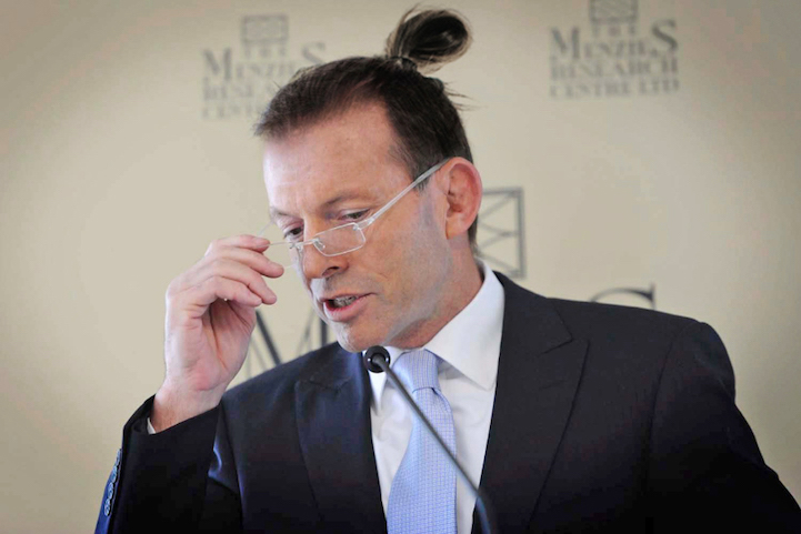 Tony Abbott a kontytól sem tűnik lazának.