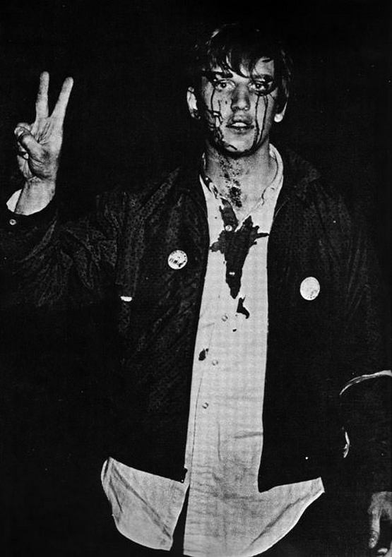 1968_aprilis_columbia_student_flashes_the_peace_sign_after_being_beaten_by_riot_police_at_an_antiwar_demonstration.jpg