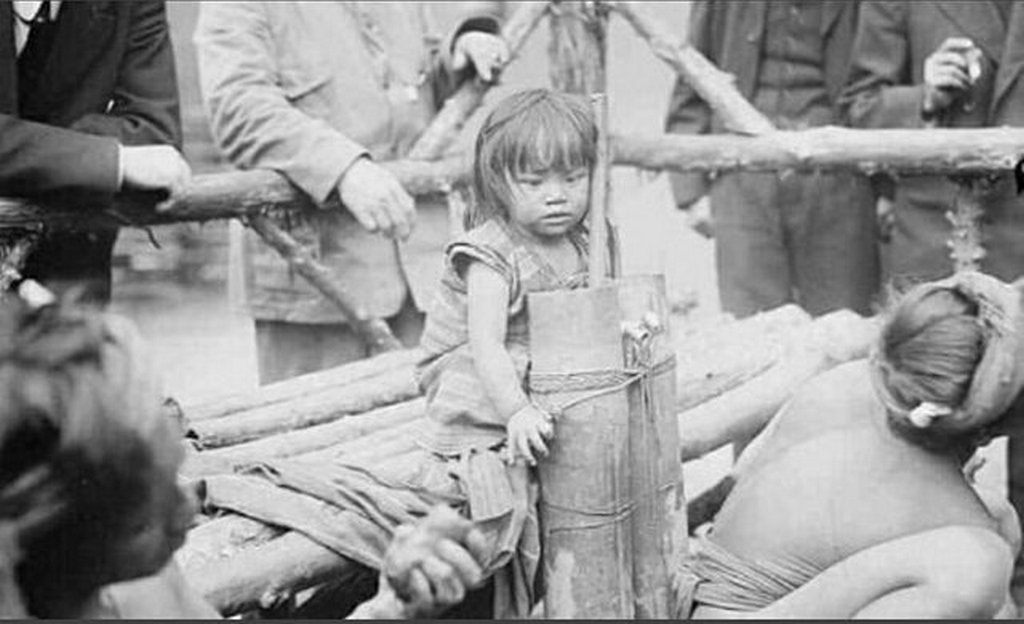 1914_girl_from_philippines_she_was_displayed_at_the_coney_island_zoo_she_was_a_zoo_attraction_among_the_monkeys_and_lizards_she_was_bound_by_ropes_visitors_threw_her_peanuts.jpg