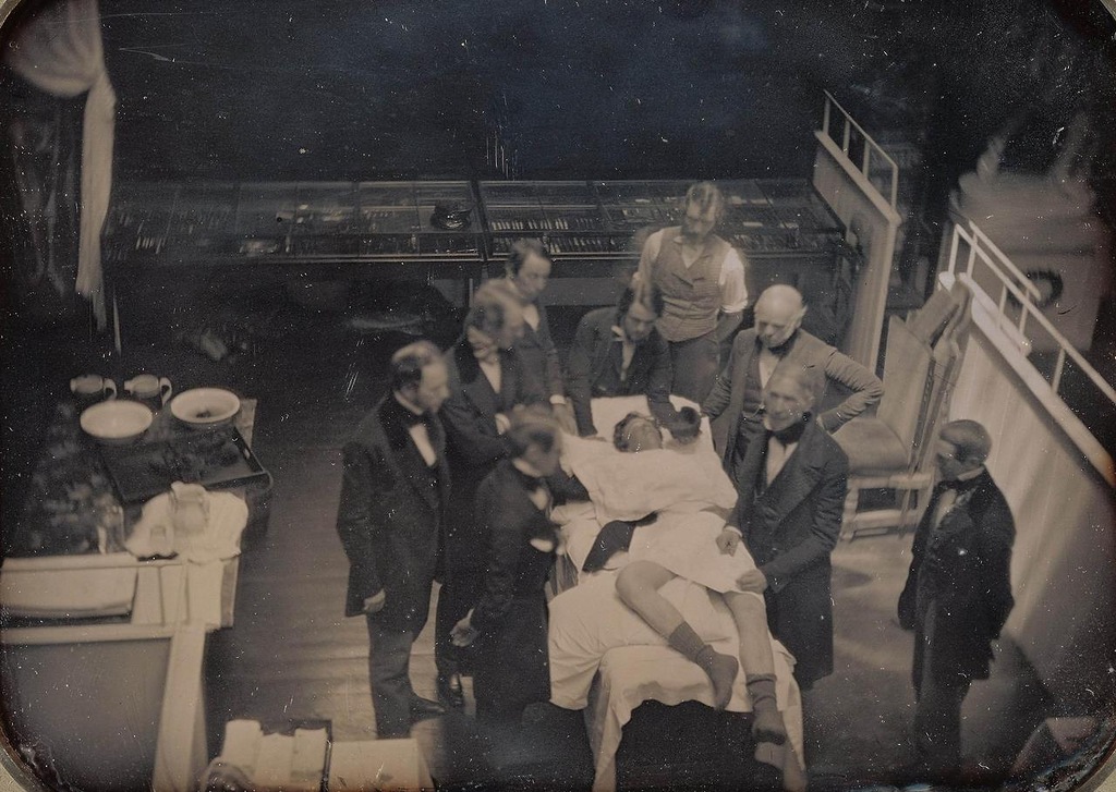 1847. Az első műtéti fotó. Éterrel elkábított betegen. Dagerrotípia Massechusets-ből..jpg