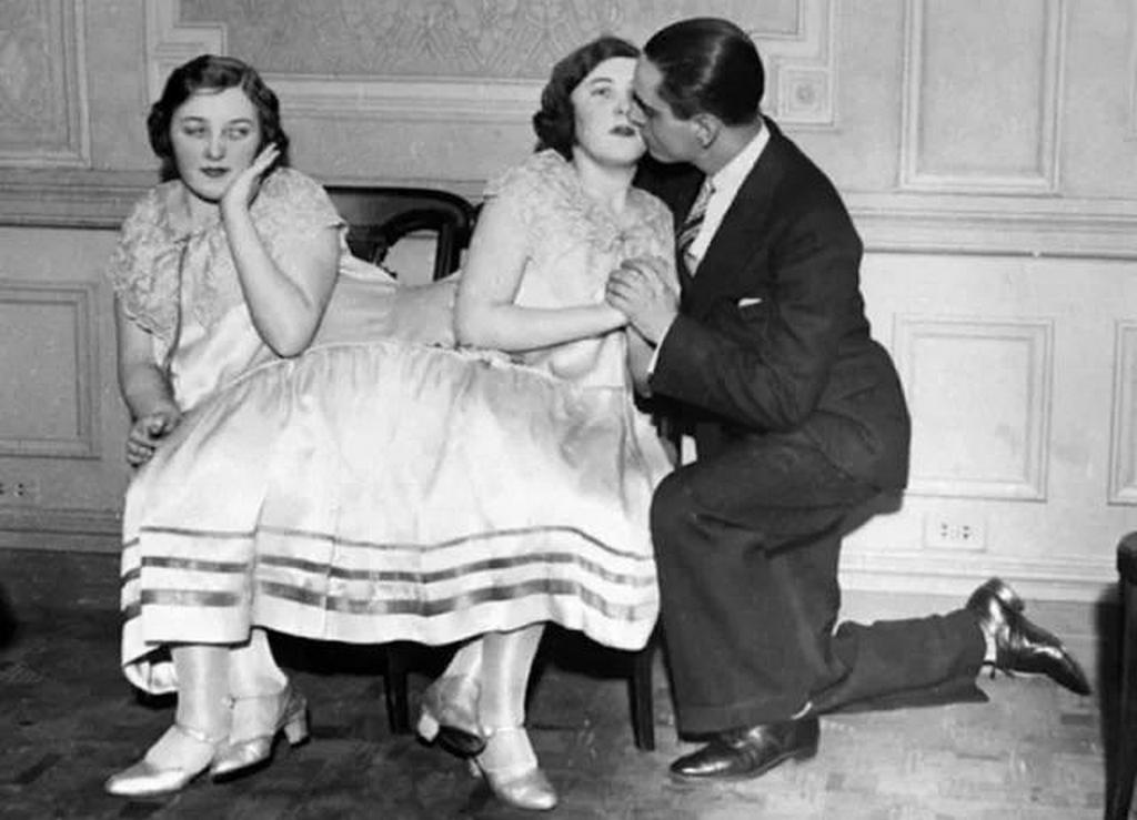 1940-es_evek_siamese_twins_margaret_and_mary_gibb_photographed_while_margaret_kisses_her_boyfriend.jpeg