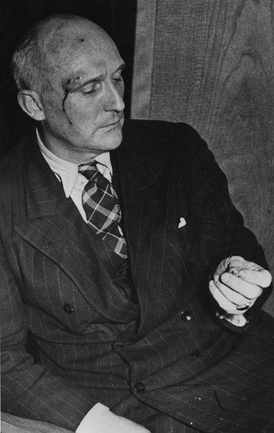 1950_bundestag_member_wolfgang_hedler_german_party_after_being_beaten_up_by_spd_deputies_over_previous_pro-hitler_anti-semitic_speech.png