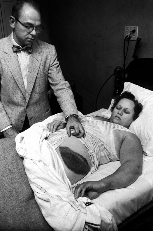 1954_az_amerikai_ann_hodges-t_almaban_sebesitette_meg_egy_meteorit.jpeg