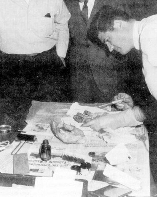 1967. Che Guevara kezei. Meggyilkolása után a forradalmár kézfejeit levágták, hogy további azonosításra (ujjlenyomat) szállítsák tovább. A kezek későbbi sorsa ismeretlen, az 1997-ben feltárt sírban sem találták meg..JPG
