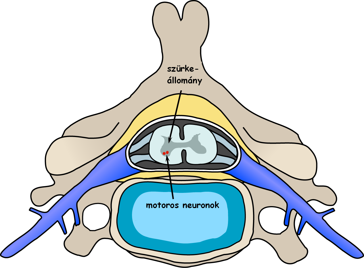 polio_spinal_diagram.PNG