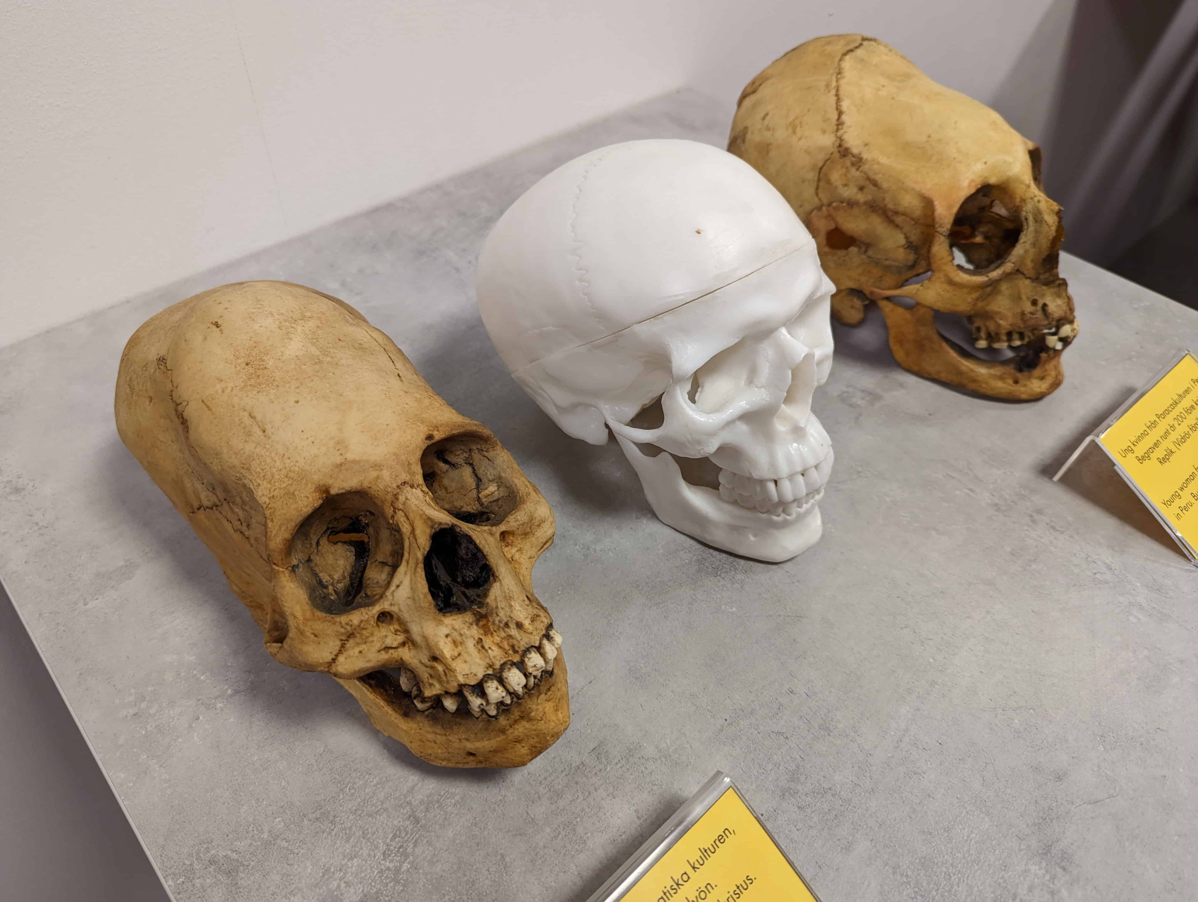 Néhány különleges koponya