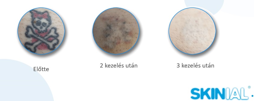 halalfej.jpg