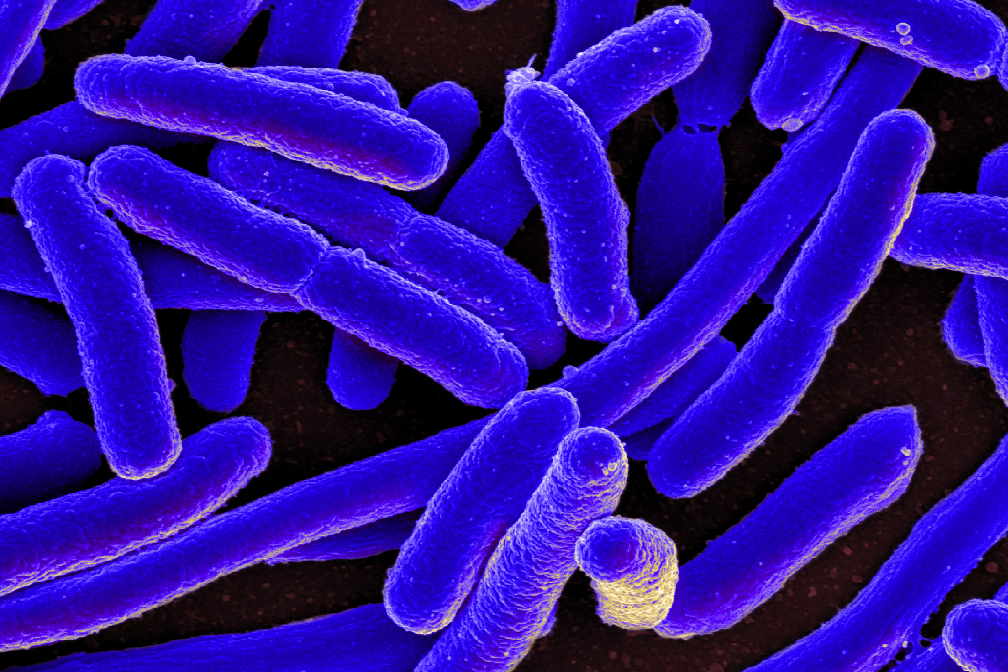 e_coli_bacteria_16578744517_wikiedited.jpg