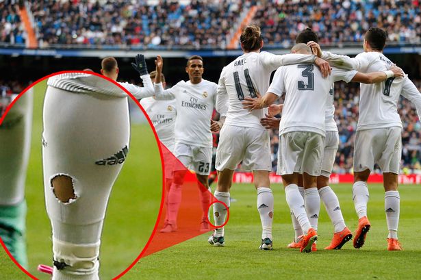 Gareth Bale sérülést megelőző döntései