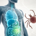 Rejtélyes emésztési problémák, hirtelen megjelenő intoleranciák: lehet, hogy a Lyme-kór áll a háttérben?