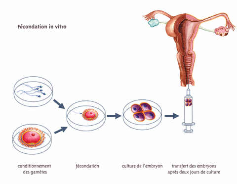 mesterséges megtermékenyítés fiv.jpg
