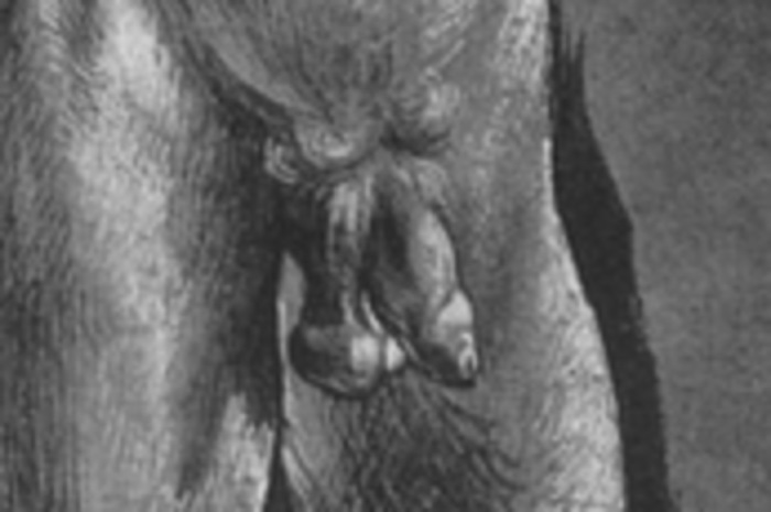 toxikus_pruderia_durer_x_1.jpg