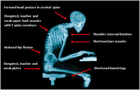 physical-anatomy-problems-sitting-computer-wrong-posture.jpg
