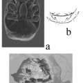 Urodiaspis fajok Erdélyben