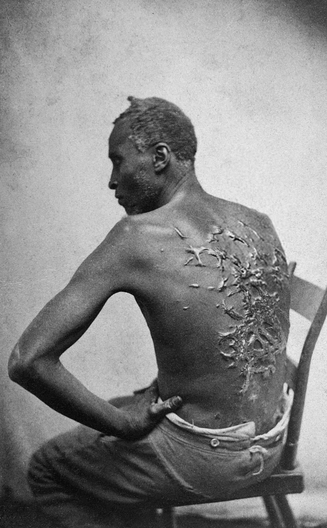 scourged_back_by_mcpherson_oliver_1863_retouched.jpg