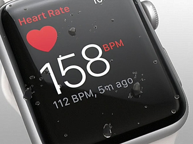 A jövő Apple Watch-ai már gyárilag EKG-val érkezhetnek