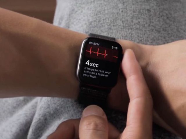 Életet mentett az Apple Watch EKG funkciója