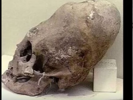 skull.jpg