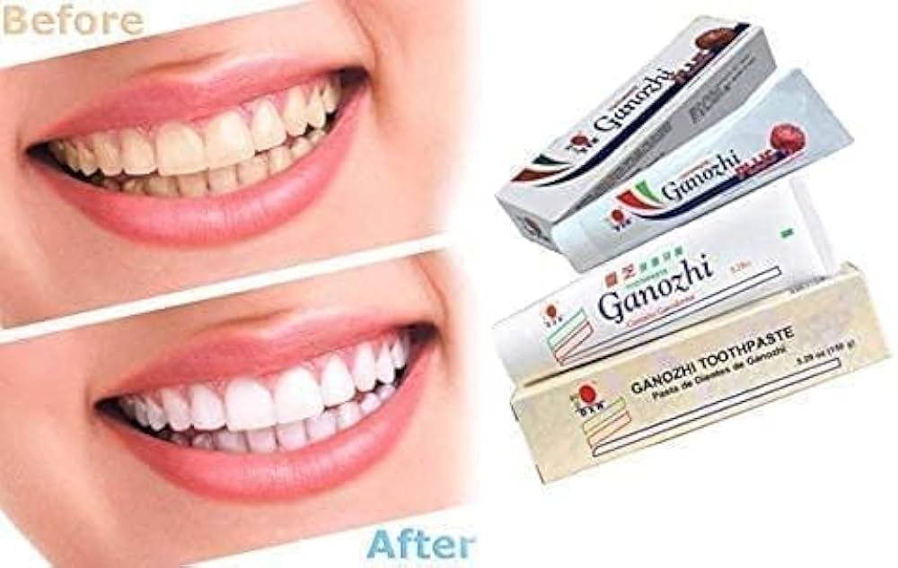 ganozhi_fogkrem_toothpaste_for_whitening_teeths.jpg