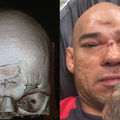 TD|MMA: Karambolban törnek be úgy koponyák, ahogy Cyborgé tört MVP térde alatt