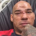 TD|MMA: Cyborg: három hónap, és újra harcolhatok