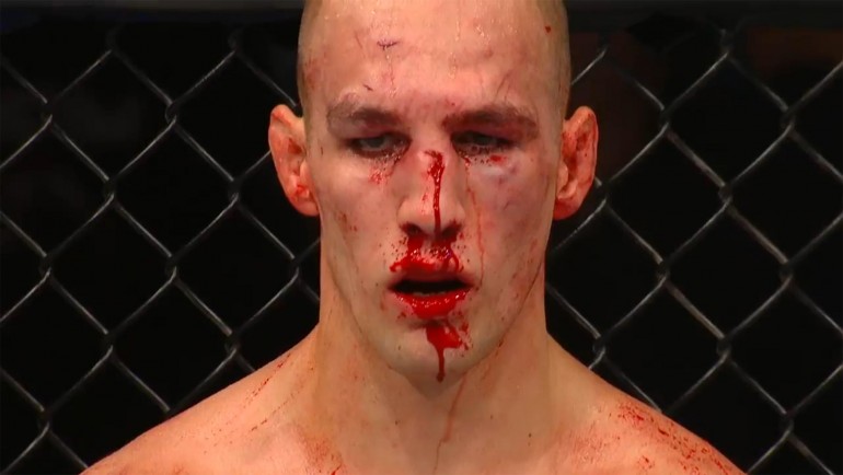 rory-bloodied.jpg