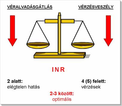 inr_merleg.jpg