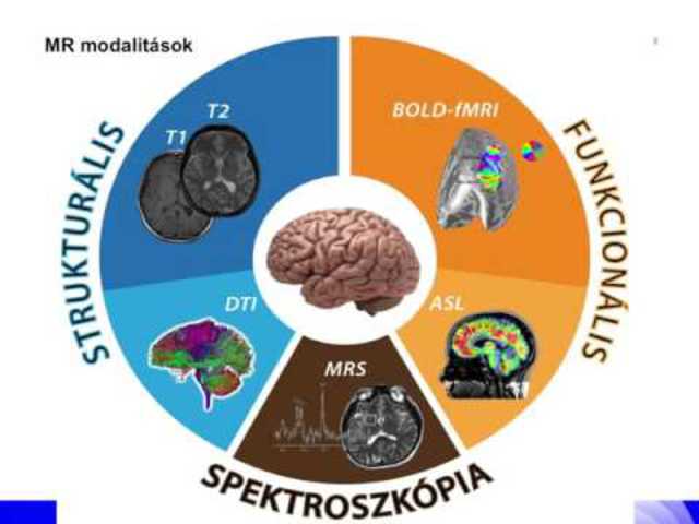 Funkcionális MRI az agykutatásban - mítosz és valóság (video)