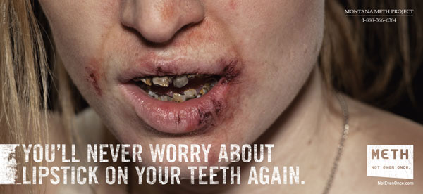 Soha többé nem fogsz aggódni hogy rúzsosak lettek a fogaid...