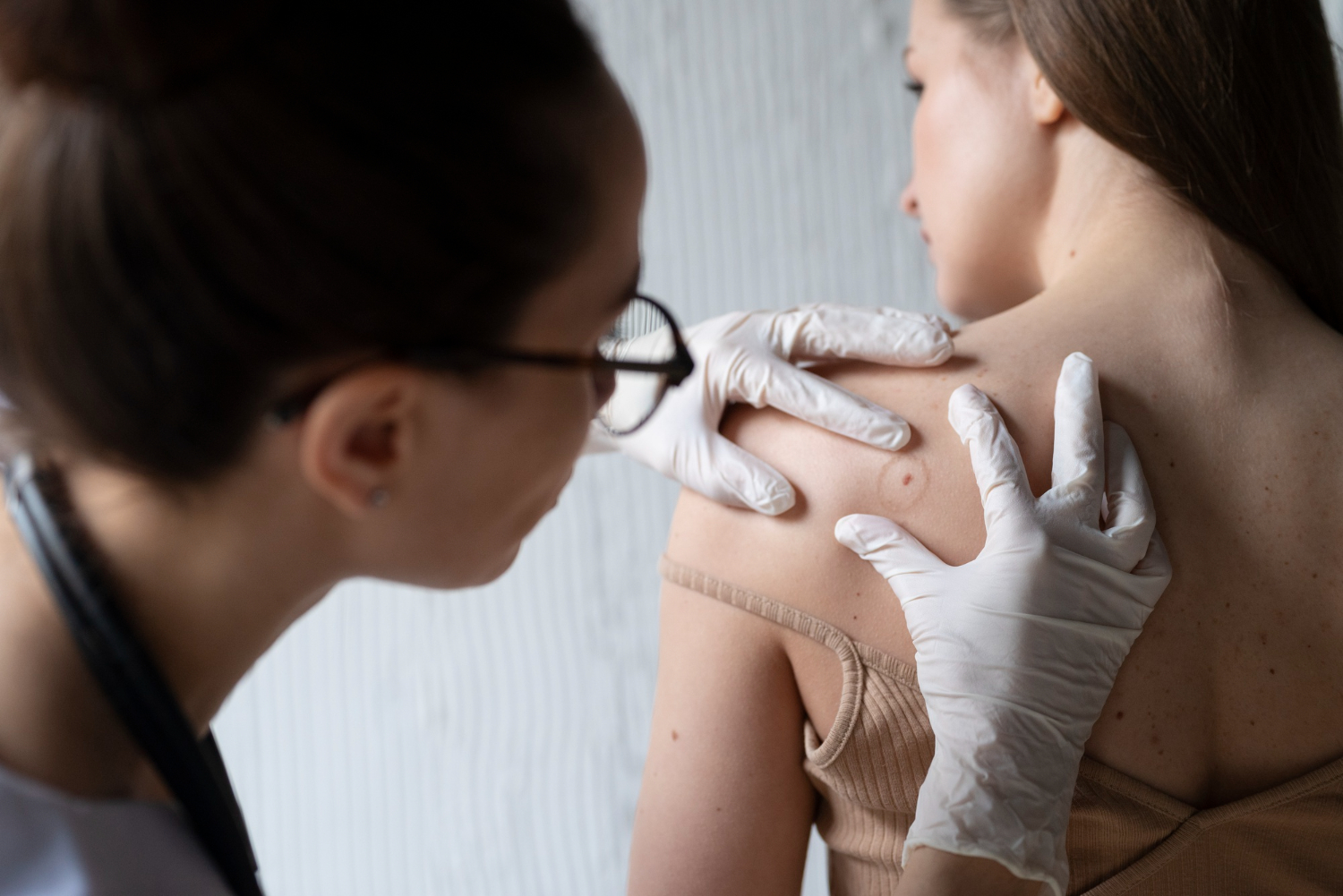 melanoma_kiujulasa.jpg