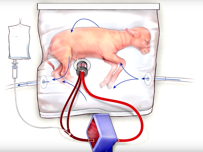 artificial-womb.png
