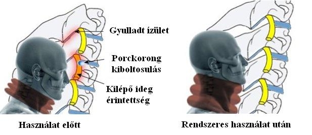 nyak17.jpg