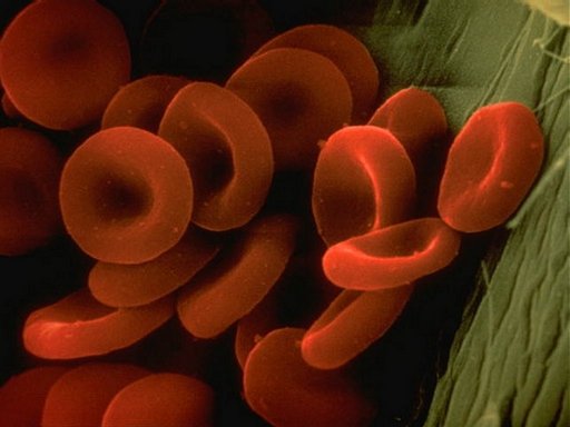 red_blood_cells.jpg