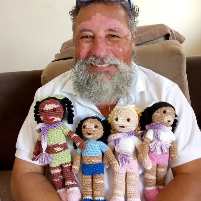 vitiligo-grandfather-knits-dolls-joao-stanganelli-junior-1-1-5d8088ef765a6_700.jpg