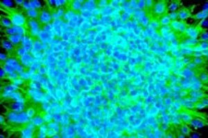 Stem-Cells-Repair-and-Regenerating-Tissue-Damaged-by-Heart-Attack.jpg