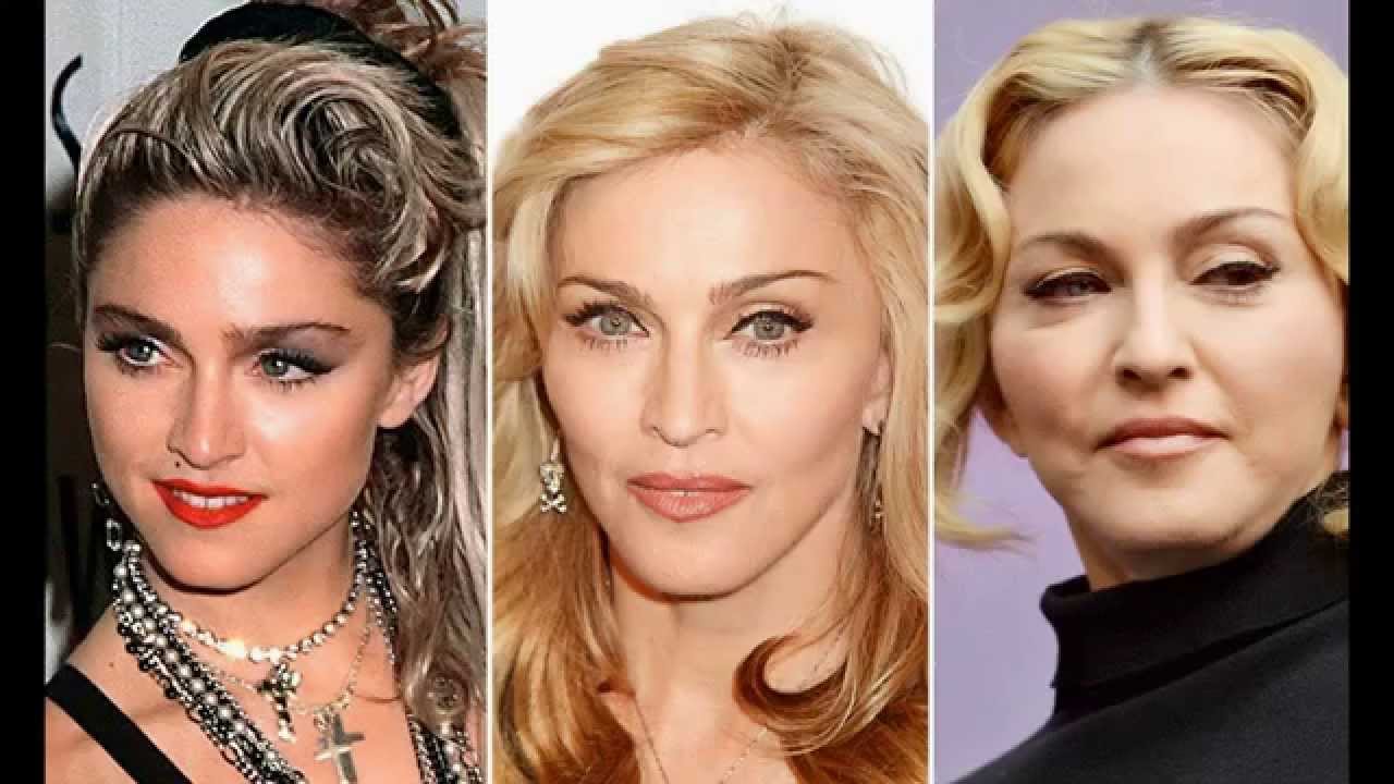 madonna-plastic-surgery-before-and-after.jpg